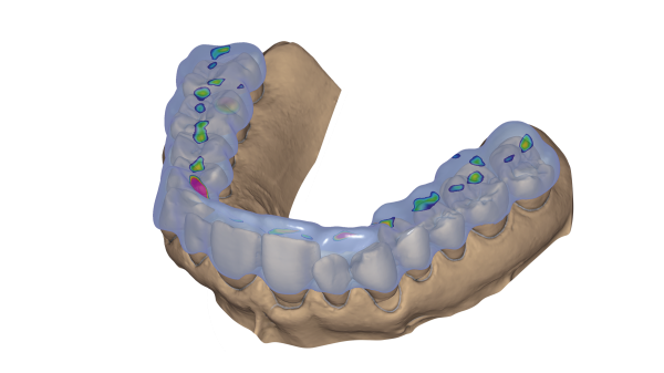 Bite Splint Module Upgrade Bite Splint Module Upgrade