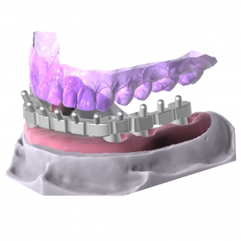 Bar Module Bar Module