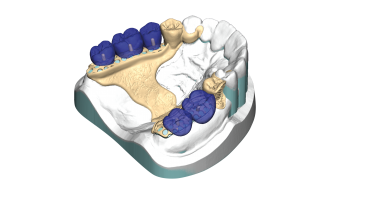 PartialCAD Module PartialCAD Module