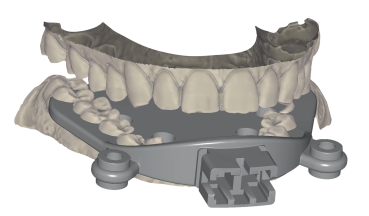 Jaw Motion Import Upgrade Jaw Motion Import Upgrade