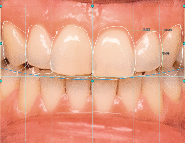 Smile Creator Module Smile Creator Module