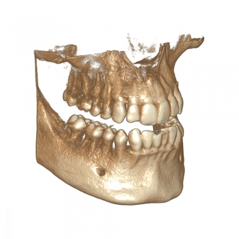 DICOM Viewer Module Upgrade DICOM Viewer Module Upgrade