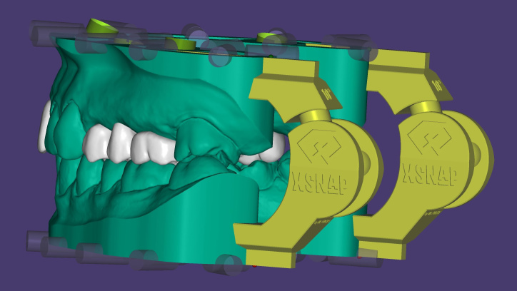 xSNAP® Add-on Module for Model Creator xSNAP® Add-on Module for Model Creator